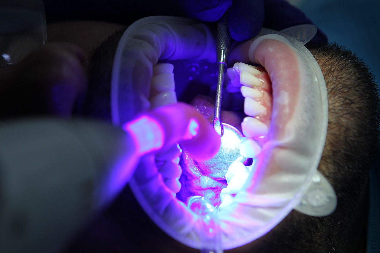 candidiasis oral