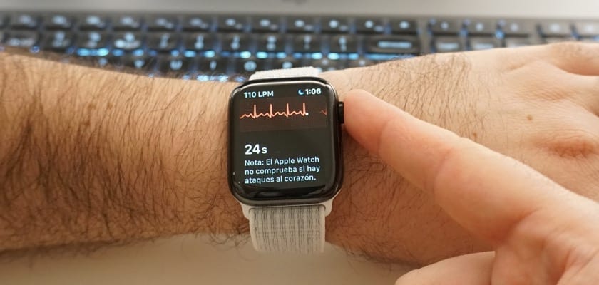 Urgently operated after an ECG with your Apple Watch